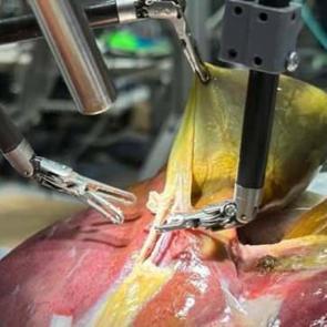 Ameliyatlar değişiyor! Tarihte ilk kez bir robot, yardım almadan gerçekleştirdi!