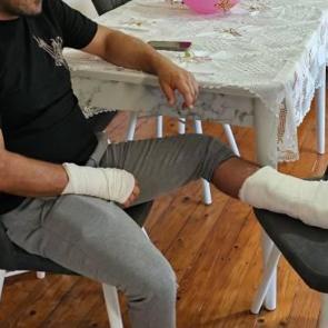 Başıboş sokak köpeğinin saldırısına uğrayan adamın ayağı 2 yerden kırıldı