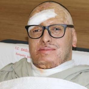 6 bin voltluk akıma kapıldı, ölümden döndü! 