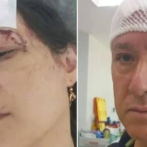 Tatilde kabusu yaşadılar! Demir sopalarla d&ouml;v&uuml;l&uuml;p hastanelik oldular