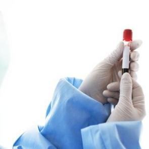 Sepsis her yıl 11 milyon insanı öldürüyor: İşte belirtiler ve korunma yolları