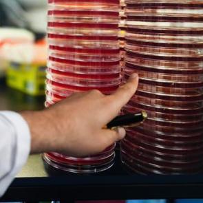 Uzayda göz sağlığına Türk katkısı