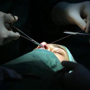 Merdiven altı estetik ve dövme İşlemlerine karşı uzman uyarısı