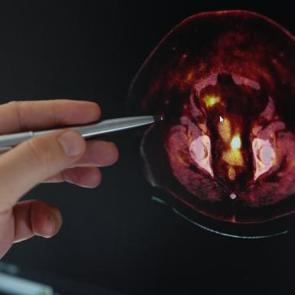 Obezitede kanser riski