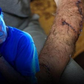 Karısı tarafından 17 yerinden bı&ccedil;aklanmıştı! Yine evsiz kaldı