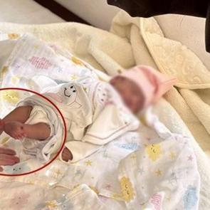 Elsiz ve ayaksız doğacaktı! Anne karnında müdahale