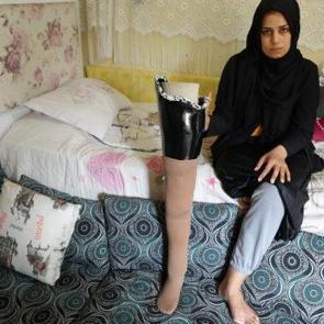 Depremde bacağını kaybeden kadın kocası tarafından terk edildiğini iddia etti