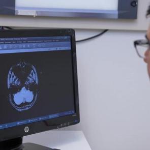 İnme, her yaşta görülebilir: İlk 24 saat hayati önem taşıyor