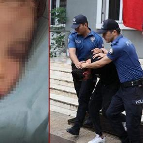 2 yaşındaki bebeği darbederek hastanelik etmişlerdi! Anne hakkında gelişme 