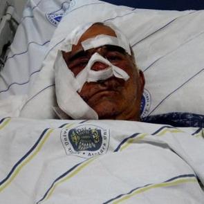 Hayvan otlatırken ayı saldırısına uğradı: Elmacık kemiği koptu! 