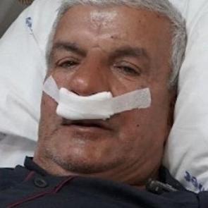 27 yıllık mesleğin şaşırtan sonucu: Burnundan 100 gramlık taş çıktı 