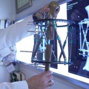 Boy kısalığında çığır açan tedavi: Günde 1 milimetre uzatan yöntem