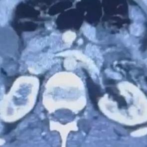 &Uuml;&ccedil; İranlı r&ouml;ntgene girince yakayı ele verdi
