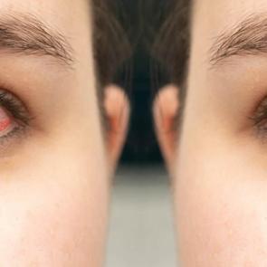 Uzmanı uyarıyor: Kış aylarında soğuk hava ve kapalı ortamlar, g&ouml;z sağlığını tehdit ediyor!