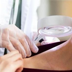 Cilt kanseri riskini 3 kata yakın artırıyor! Pop&uuml;ler diye yapmayın