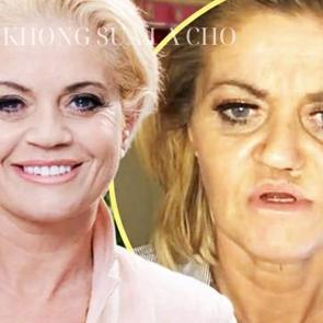 Uyuşturucu &uuml;nl&uuml; yıldızın y&uuml;z&uuml;n&uuml; mahvetti