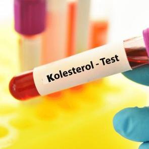 Bu besinler kolesterol&uuml;n&uuml;z&uuml; d&uuml;ş&uuml;r&uuml;yor! Yiyenlerin imdadına yetişiyor