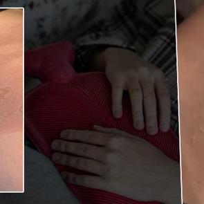 Yine sıcak su torbası yine facia: 3 dakika sonra patladı!