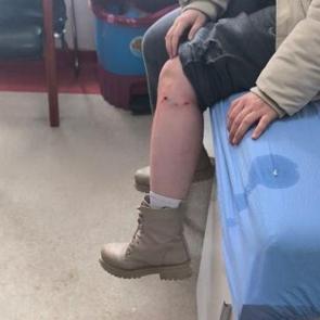 Kız &ccedil;ocuğuna sokak k&ouml;peği saldırısı! Zabıta amirine soruşturma a&ccedil;ıldı