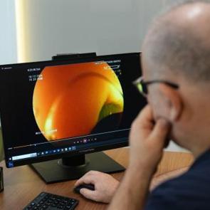 Uzman isim uyardı: Sosyal medyadaki bakırsak detoksu trendi sağlığı tehdit ediyor