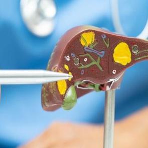 Bu kansere dikkat: Tedavi edilmezse yaşam oranı %15'lere d&uuml;ş&uuml;yor!