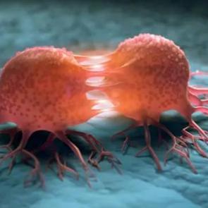 Kanser h&uuml;crelerini &ouml;ld&uuml;r&uuml;yor! Yeni tedavi y&ouml;ntemi şaşkına &ccedil;evirdi