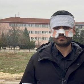 Okulda korku dolu anlar! Eskişehir'de &ouml;ğretmen meslektaşının y&uuml;z&uuml;n&uuml; yaktı iddiası