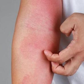 İstanbul'da kuduz iddiası! Valilikten a&ccedil;ıklama geldi