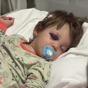 14 aylık bebeğin kafatası &ccedil;atlamıştı: T&uuml;rkiye'nin ayağa kalktığı olayda alt komşu konuştu