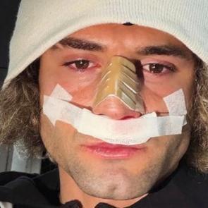 2. Lig'in gol kralının burnu kırıldı! Ma&ccedil;ı bu şekilde tamamladı