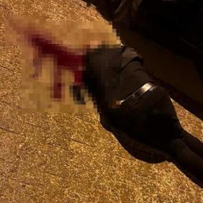 Korkun&ccedil; olay! Sokakta y&uuml;r&uuml;rken başından vuruldu
