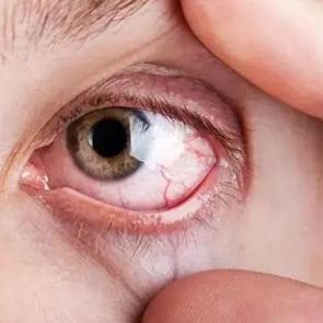 Elinizi bile s&uuml;rmeyin: G&ouml;rme kaybına yol a&ccedil;ıyor! Acilen bunu yapın