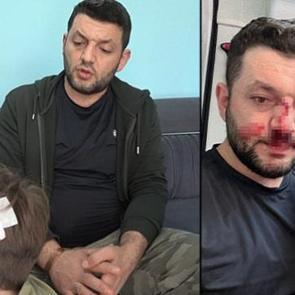 Yalova'da baba ile 14 aylık bebek darbedilmişti! Ailenin 8 yaşındaki &ccedil;ocuğu taşlandı