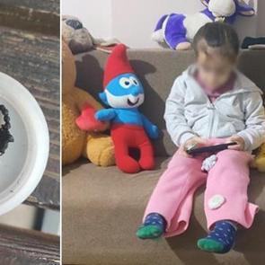 5 yaşındaki &ccedil;ocuğun burnundan &ccedil;ıkan şoke etti! 2 yıl sonra fark edildi 