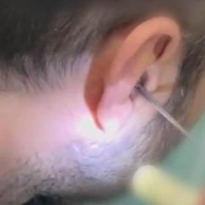 Kayseri'de akılalmaz olay: Kulağına gizlediği uyuşturucuyla yakalandı