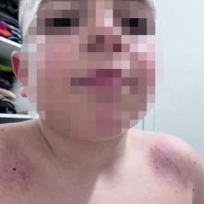 Antalya'da İlkokulda darp iddiası! Aile &ouml;ğretmenden şikayet&ccedil;i oldu