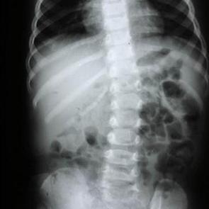 Omurga sağlığı i&ccedil;in nelere dikkat edilmeli? Uzman isim a&ccedil;ıkladı 