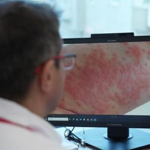 Uzmanından uyarı: Egzamalı &ccedil;ocuğa ezbere diyet yaptırmayın