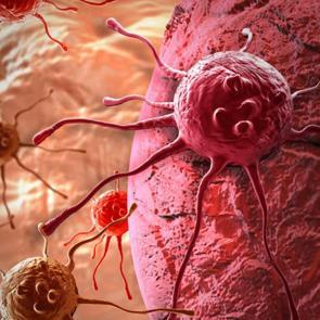 V&uuml;cudunuzun sessiz uyarıları: Kanser &ouml;ncesi belirtileri g&ouml;z ardı etmeyin!