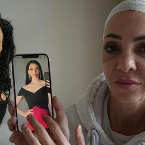 Y&uuml;z&uuml; par&ccedil;alanan annenin hukuk m&uuml;cadelesi: Hem darbedildi hem tehdit ediliyor