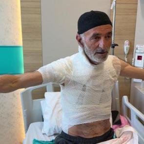 Erzurum'da arızayı tamir etmek isterken hastanelik oldu