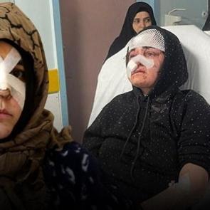 27 yaşındaki Nazlı dehşeti yaşadı! Kaldırım taşı 'silah' sayıldı