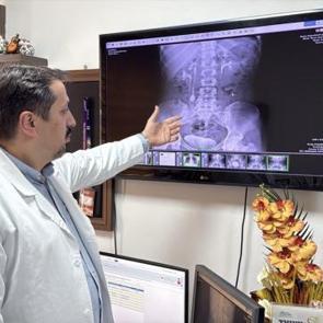 İdrar kanalından &ccedil;ıkan 51 taş doktor, hasta ve yakınlarını şaşırttı