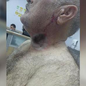 Yere d&uuml;ş&uuml;rd&uuml;, &uuml;st&uuml;nde tepindi: At, sahibini boğazından ısırdı!