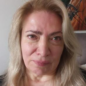 Ankara'da estetik kabusu: Y&uuml;z felci ge&ccedil;irdiğini iddia etti 