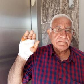 Hatay'da akılalmaz hadise: Komşusunun ısırdığı parmak koparıldı 