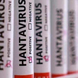 Herkesin aklında tek soru! Hantavir&uuml;s insandan insana bulaşır mı?