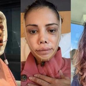 Kore'de y&uuml;z nakli ge&ccedil;irmişti! Gelen yorumla &ccedil;ileden &ccedil;ıkmıştı