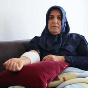 Elazığ'da k&ouml;pek saldırısına uğrayan kadın: Beni parampar&ccedil;a ederdi 