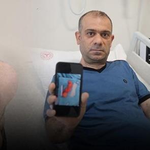 Sırtındaki şişliği &ouml;nemsemedi! Yıllar i&ccedil;inde b&uuml;y&uuml;d&uuml;! Doktorları şoke eden vaka